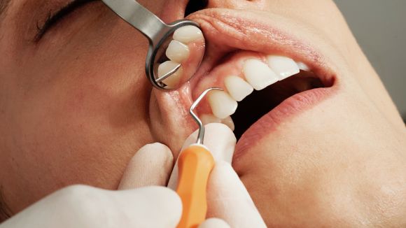 Prévention et Hygiène bucco-dentaire